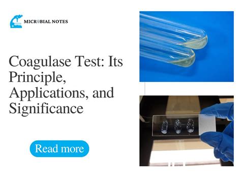Coagulase Test: Principle, Applications, and Significance .